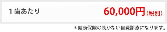 ラミネートベニア,1歯治療料金6万円
